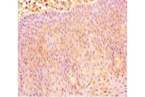 Immunohistochemistry of paraffin-embedded human tonsil tissue using ABIN7146107 at dilution of 1:100 (CXCR4 抗体  (AA 1-356))