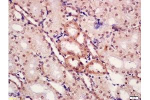 Formalin-fixed and paraffin embedded rat kidney tissue labeled with Anti-CTBP1 (Ser422) Polyclonal Antibody, Unconjugated  at 1:300 followed by conjugation to the secondary antibody and DAB staining. (CTBP1 抗体  (pSer422))