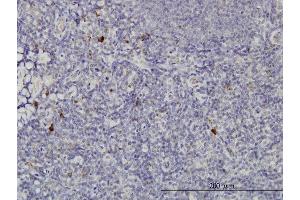 Immunoperoxidase of monoclonal antibody to NKIRAS2 on formalin-fixed paraffin-embedded human tonsil. (NKIRAS2 抗体  (AA 1-191))