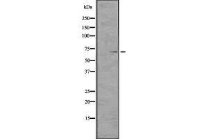 Western blot analysis of TCHP expression in CEM cell lysate ,The lane on the left is treated with the antigen-specific peptide. (TCHP 抗体  (C-Term))