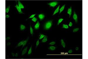 Immunofluorescence of monoclonal antibody to TESK2 on HeLa cell. (TESK2 抗体  (AA 405-542))