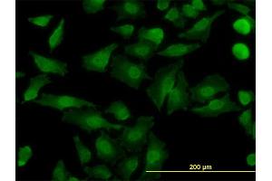 Immunofluorescence of monoclonal antibody to NDE1 on HeLa cell. (NDE1 抗体  (AA 1-335))