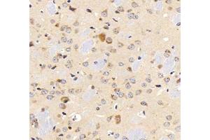 Immunohistochemistry analysis of paraffin-embedded mouse lung using,MFAP4 (ABIN7074614) at dilution of 1: 2000 (MFAP4 抗体)