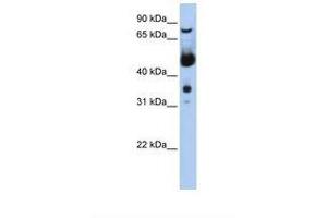 Image no. 1 for anti-Menage A Trois Homolog 1, Cyclin H Assembly Factor (Xenopus Laevis) (MNAT1) (N-Term) antibody (ABIN6739103)