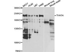 Western blot analysis of extracts of various cell lines, using THADA antibody. (THADA 抗体)