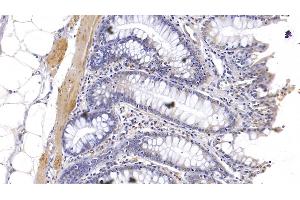 Detection of KPNa3 in Human Colon Tissue using Polyclonal Antibody to Karyopherin Alpha 3 (KPNa3) (KPNA3 抗体  (AA 3-220))