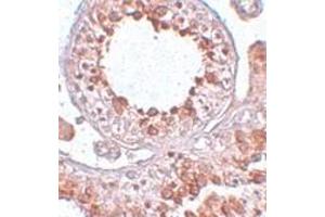 Immunohistochemistry of ESX1 in human testis tissue with ESX1 antibody at 2. (ESX Homeobox 1 抗体  (Center))