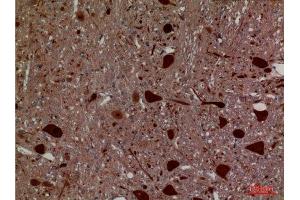 Immunohistochemistry (IHC) analysis of paraffin-embedded Rat Brain, antibody was diluted at 1:100. (Hexosaminidase A 抗体  (Internal Region))