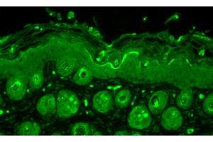 Ubiquitin, Mouse backskin. (Ubiquitin 抗体)