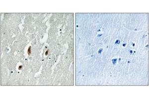 Immunohistochemistry analysis of paraffin-embedded human brain tissue, using SRF (Ab-77) Antibody. (SRF 抗体  (AA 41-90))