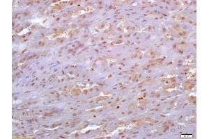 Formalin-fixed and paraffin embedded mouse stomach labeled with Anti-SDF4 Polyclonal Antibody, Unconjugated (ABIN720595) at 1:200 followed by conjugation to the secondary antibody and DAB staining (SDF4 抗体  (AA 121-230))