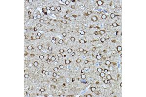 Immunohistochemistry (IHC) image for anti-Dihydropyrimidinase-Like 2 (DPYSL2) (AA 400-500) antibody (ABIN7266769)