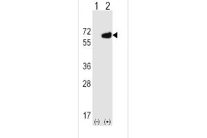 Western blot analysis of NT5E using rabbit polyclonal NT5E Antibody (M535) using 293 cell lysates (2 ug/lane) either nontransfected (Lane 1) or transiently transfected (Lane 2) with the NT5E gene. (CD73 抗体  (C-Term))