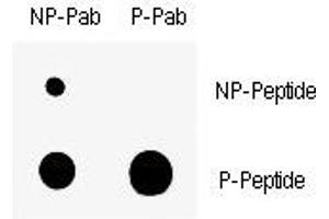 Dot blot analysis of nonphos (NP) and phospho-Wee1 antibody (P). (WEE1 抗体  (pSer123))