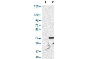Western Blot analysis of Lane 1: negative control (vector only transfected HEK293T cell lysate) and Lane 2: over-expression lysate (co-expressed with a C-terminal myc-DDK tag in mammalian HEK293T cells) with XCR1 polyclonal antibody . (XCR1 抗体)