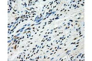 Immunohistochemical staining of paraffin-embedded endometrium tissue using anti-HK2mouse monoclonal antibody. (Hexokinase 2 抗体)