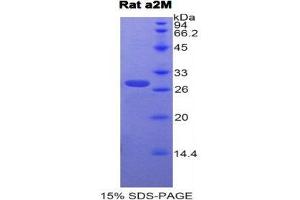 SDS-PAGE (SDS) image for alpha-2-Macroglobulin (A2M) (AA 818-1048) protein (His tag) (ABIN2120527)