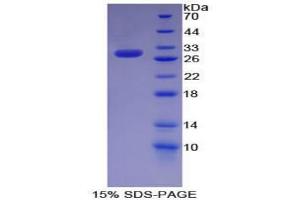 SDS-PAGE (SDS) image for KH Domain Containing, RNA Binding, Signal Transduction Associated 1 (KHDRBS1) protein (ABIN3010352)