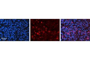 Rabbit Anti-CCNB1 Antibody   Formalin Fixed Paraffin Embedded Tissue: Human Lymph Node Tissue Observed Staining: Cytoplasm Primary Antibody Concentration: 1:600 Other Working Concentrations: N/A Secondary Antibody: Donkey anti-Rabbit-Cy3 Secondary Antibody Concentration: 1:200 Magnification: 20X Exposure Time: 0. (Cyclin B1 抗体  (C-Term))