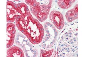 Immunohistochemistry (IHC) image for anti-Solute Carrier Family 6 (Neurotransmitter Transporter, Dopamine), Member 3 (SLC6A3) (EL2 Region) antibody (ABIN1104350)