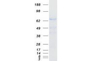 Western Blotting (WB) image for UDP-N-Acetyl-alpha-D-Galactosamine:polypeptide N-Acetylgalactosaminyltransferase 7 (GalNAc-T7) (GALNT7) protein (Myc-DYKDDDDK Tag) (ABIN2721668)