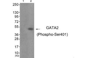 Western blot analysis of extracts from JK cells (Lane 2), using GATA2 (Phospho-Ser401) Antibody.