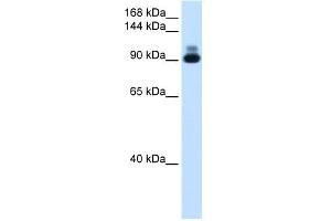 WB Suggested Anti-ACTN2 Antibody Titration:  1. (ACTN2 抗体  (C-Term))