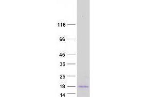 Validation with Western Blot (YPEL5 Protein (Transcript Variant 4) (Myc-DYKDDDDK Tag))