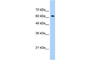 Human Jurkat; WB Suggested Anti-ZNF675 Antibody Titration: 1. (ZNF675 抗体  (C-Term))