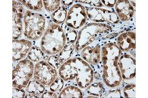 Immunohistochemical staining of paraffin-embedded Kidney tissue using anti-BTK mouse monoclonal antibody. (BTK 抗体)