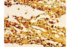 Immunohistochemistry (IHC) image for anti-Histone H1.4 (HIST1H1E) antibody (ABIN7139414)