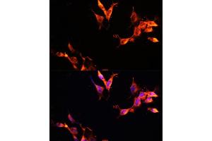 Immunofluorescence analysis of NIH-3T3 cells using L Polyclonal Antibody (ABIN6133274, ABIN6143083, ABIN6143084 and ABIN6215309) at dilution of 1:100 (40x lens). (LAMTOR1 抗体  (AA 1-161))