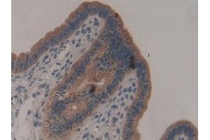 Detection of ADAMTS2 in Mouse Uterus Tissue using Polyclonal Antibody to A Disintegrin And Metalloproteinase With Thrombospondin 2 (ADAMTS2)