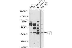 Western blot analysis of extracts of various cell lines, using UTS2R antibody (ABIN3017070, ABIN3017071, ABIN3017072 and ABIN6219939) at 1:1000 dilution. (UTS2R 抗体  (AA 280-389))