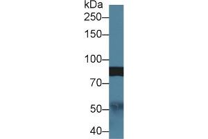 Detection of Slit1 in Rat Cerebrum lysate using Polyclonal Antibody to Slit Homolog 1 (Slit1)