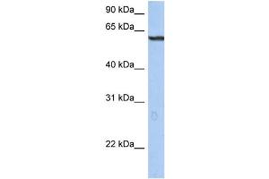 WB Suggested Anti-TRIM22 Antibody Titration: 0. (TRIM22 抗体  (N-Term))