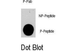 Image no. 1 for anti-Phosphoinositide-3-Kinase, Catalytic, gamma Polypeptide (PIK3CG) (pSer1100) antibody (ABIN358396) (PIK3 gamma 抗体  (pSer1100))