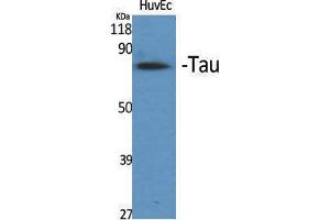 Western Blotting (WB) image for anti-tau Protein (Ser83) antibody (ABIN3177620) (tau 抗体  (Ser83))