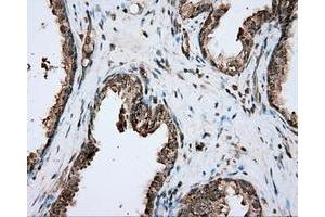 Immunohistochemical staining of paraffin-embedded prostate tissue using anti-PIM2 mouse monoclonal antibody.