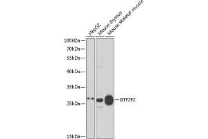 Western blot analysis of extracts of various cell lines, using GTF2F2 antibody (ABIN6131726, ABIN6141494, ABIN6141496 and ABIN6217519) at 1:1000 dilution. (GTF2F2 抗体  (AA 1-249))