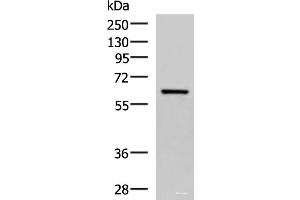 Western blot analysis of Human fetal brain tissue lysate using SARS Polyclonal Antibody at dilution of 1:850 (Seryl-tRNA Synthetase (SARS) 抗体)