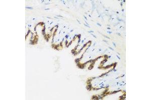 Immunohistochemistry of paraffin-embedded rat lung using KIAA1456 antibody at dilution of 1:200 (40x lens). (KIAA1456 抗体)