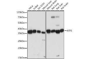 Western blot analysis of extracts of various cell lines, using  Rabbit mAb (ABIN7265406) at 1:1000 dilution. (ATF5 抗体)