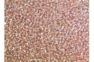 Immunohistochemistry (IHC) image for anti-Mannose-Binding Lectin (Protein C) 2, Soluble (MBL2) (AA 21-70) antibody (ABIN7189465)