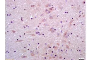 Formalin-fixed and paraffin embedded rat brain labeled with Anti-Sulfatase 2 Polyclonal Antibody, Unconjugated (ABIN750763) at 1:200 followed by conjugation to the secondary antibody and DAB staining (SULF2 抗体  (AA 651-750))