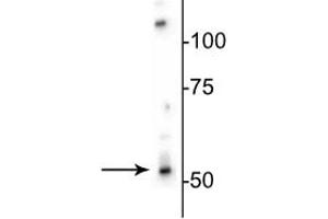 Western Blotting (WB) image for anti-gamma-aminobutyric Acid (GABA) A Receptor, beta 3 (GABRB3) (Cytoplasmic Loop) antibody (ABIN6254100)