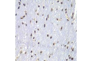 Immunohistochemistry of paraffin-embedded mouse brain using Lyn antibody (ABIN4904272) at dilution of 1:100 (40x lens). (LYN 抗体)