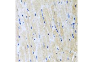 Immunohistochemistry of paraffin-embedded mouse heart using ITPKB antibody at dilution of 1:100 (x40 lens). (ITPKB 抗体)