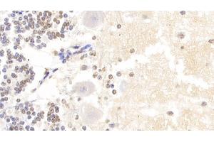 Detection of HIST2H3A in Human Cerebellum Tissue using Polyclonal Antibody to Histone Cluster 2, H3a (HIST2H3A) (HIST2H3A 抗体  (AA 1-136))