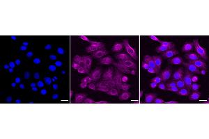 anti-Reticulon 4 Receptor-Like 1 (RTN4RL1) antibody